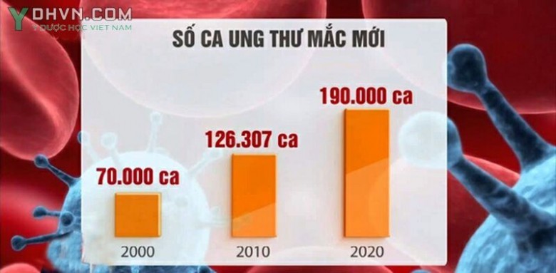 Các loại ung thư do thực phẩm không an toàn