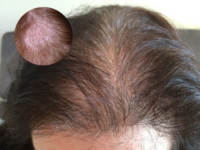 Thay vì tốn thật nhiều tiền cho những sản phẩm chăm sóc và điều trị tóc hư tổn, những thảo dược và món ăn dưới đây sẽ giúp chúng ta có được  mái tóc dày mượt mà.