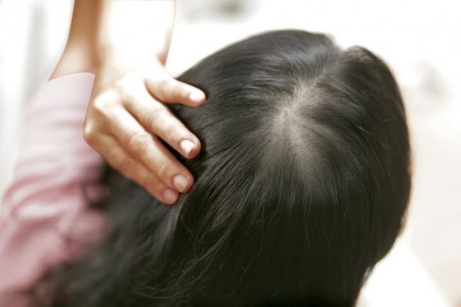 Tóc rụng nhiều phải làm sao?