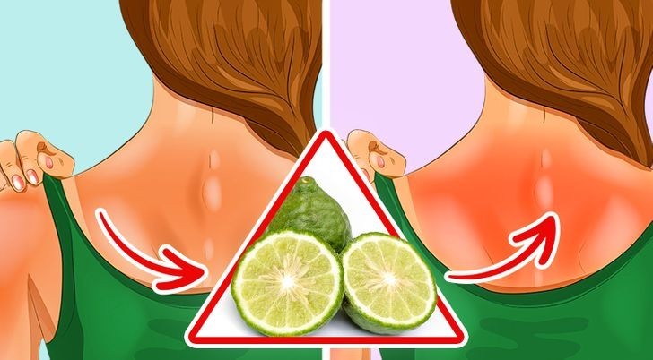 Nhạy cảm với ánh nắng mặt trời