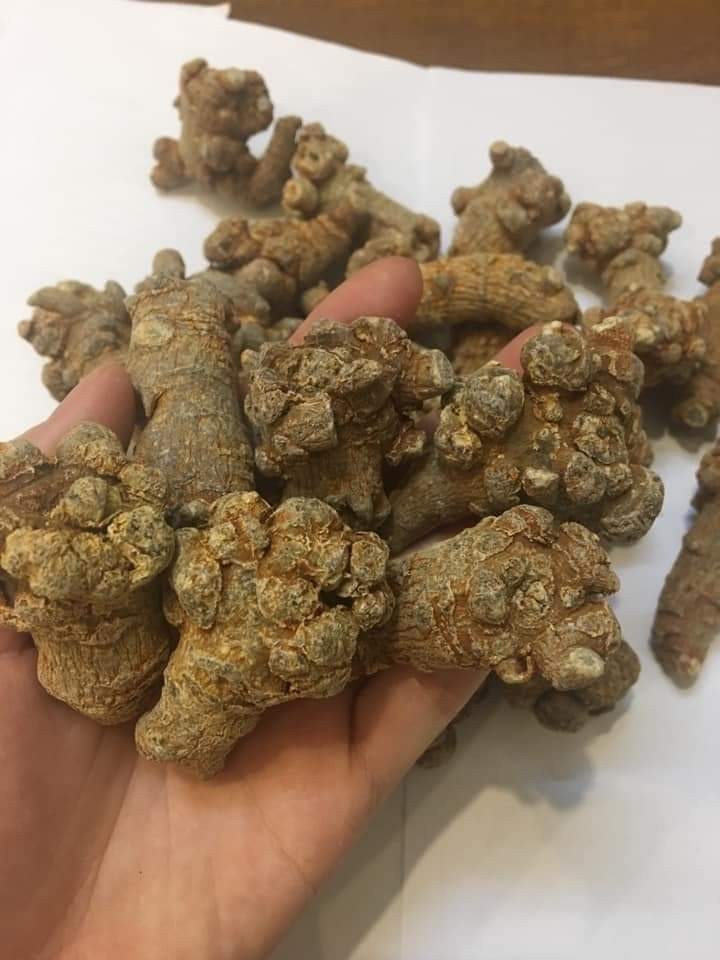 U xơ tuyến tiền liệt là bệnh thường gặp ở nam giới trung niên trở đi, tuổi càng cao tỷ lệ mắc càng nhiều.