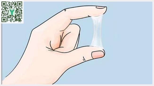 Viêm lộ tuyến cổ tử cung là gì?