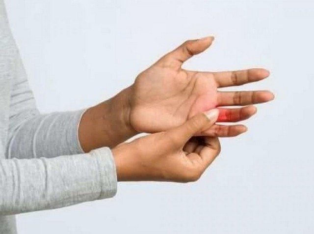 2. Cảm giác bỏng rát và mẩn đỏ trên lòng bàn tay và lòng bàn chân