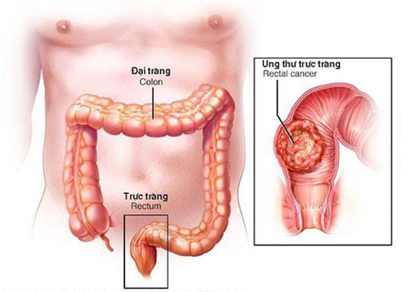 Kết quả kỳ diệu đến mức khó tin