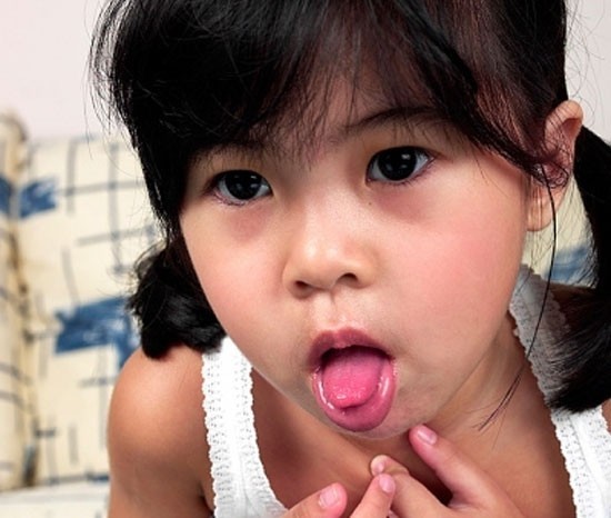 Theo các chuyên gia y tế, trẻ bị ho cha mẹ chớ nên để trẻ dùng kháng sinh mà nên áp dụng một số bài thuốc dân gian chữa bệnh hiệu quả như sau: