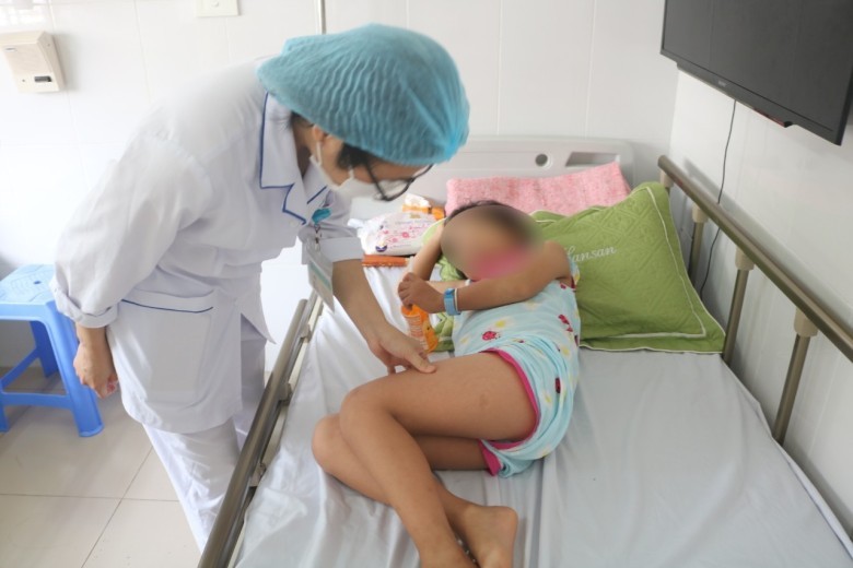 Dấu hiệu nhận biết sốt xuất huyết