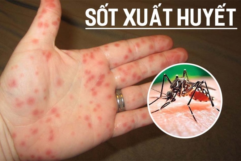 2. Lá khế phòng bệnh sốt xuất huyết.