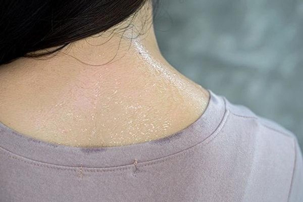 Bài thuốc điều trị ra mồ hôi lúc thức (tự hãn)