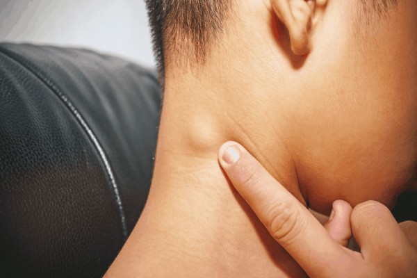Dấu hiệu ung thư máu thường gặp