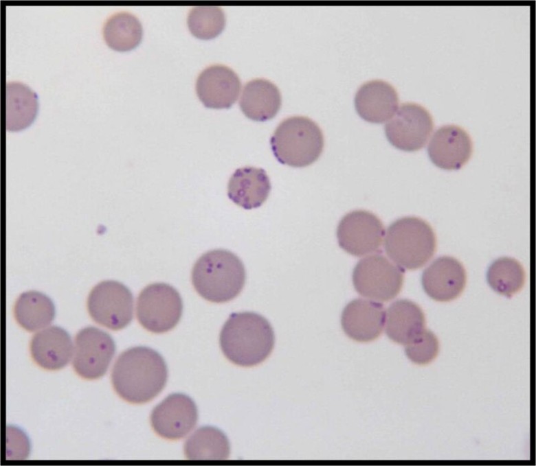 Mycoplasma là một nhóm vi khuẩn, trong đó, một số loại trong nhóm có khả năng gây bệnh ở người và động vật.