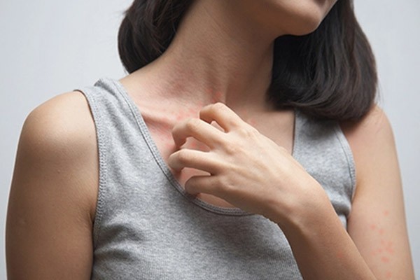 4 cơn ngứa cảnh báo bệnh nặng hoặc ung thư