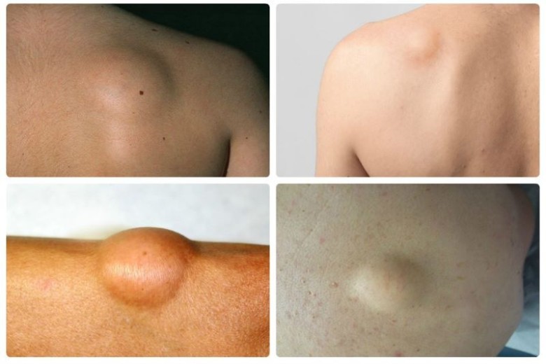 Lời khuyên của bác sĩ