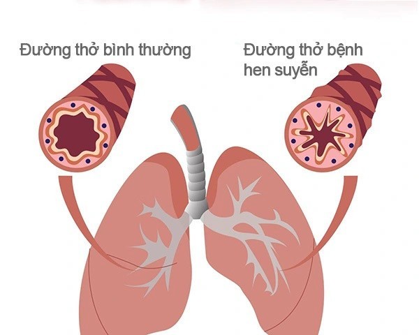 Một số bài thuốc từ cây rau khúc