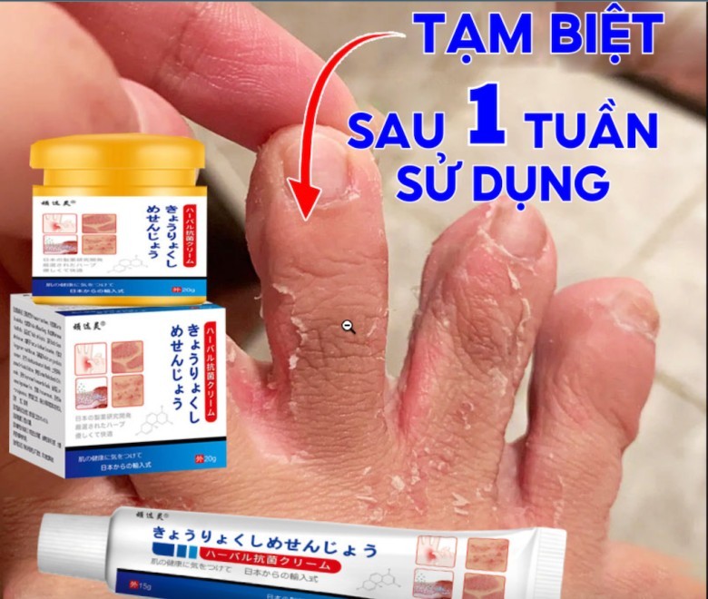 Mua Ngay Sản Phẩm Để Bảo Vệ Làn Da Mùa Mưa Lũ
