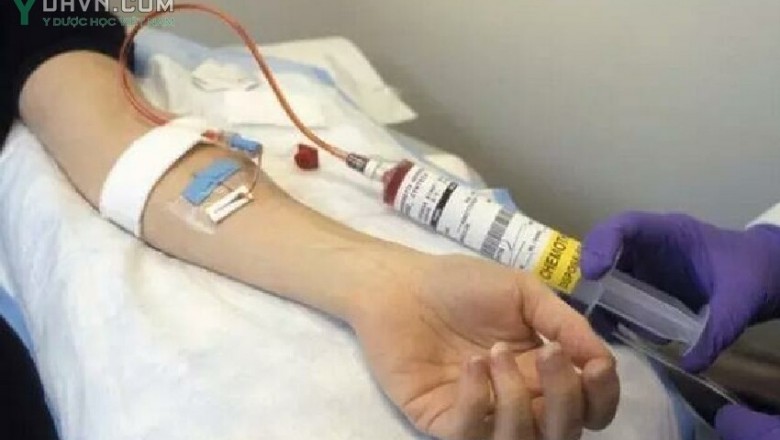 Người đang Hóa trị, xạ trị bệnh Ung Thư thì có nên uống thêm thuốc đông y?