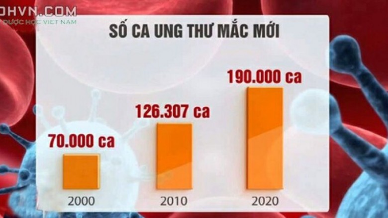 Tại sao ung thư ngày một gia tăng? có sản phẩm là món ăn ưa thích trong bữa cơm hằng ngày