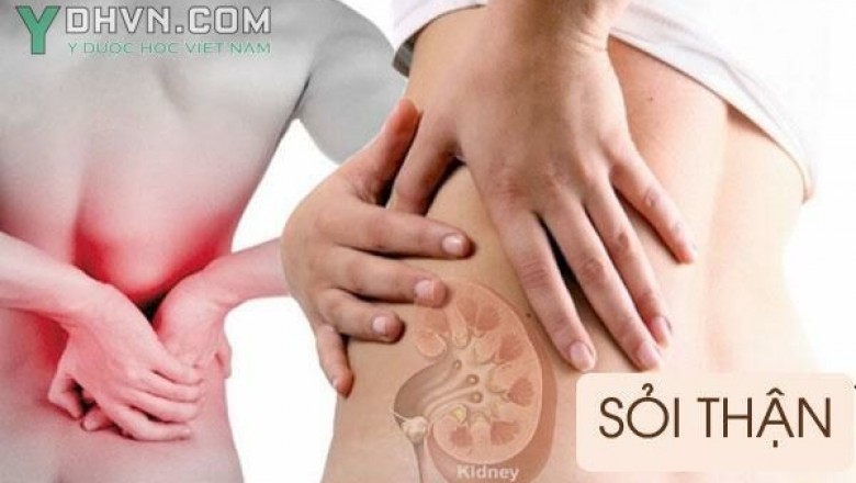 Bệnh sỏi thận, các loại sỏi thận, Nguyên nhân, Triệu chứng, điều trị, phòng bệnh