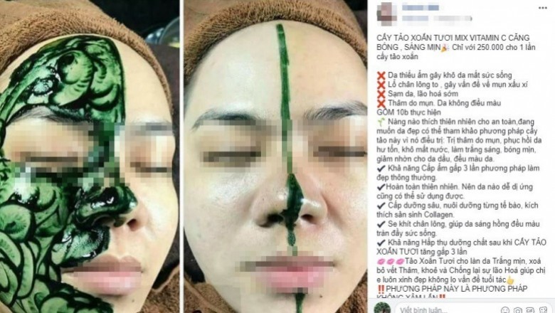 Sự thật: Cấy tảo xoắn tươi bằng phương pháp vi kim vi điểm có tác dụng làm trắng hồng, căng bóng, săn chắc, cải thiện làn da không đều màu, chống lão hóa, mờ thâm nám.