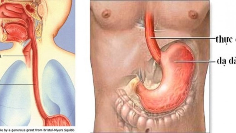 Bệnh Viêm thực quản là gì, bệnh có nguy hiểm không