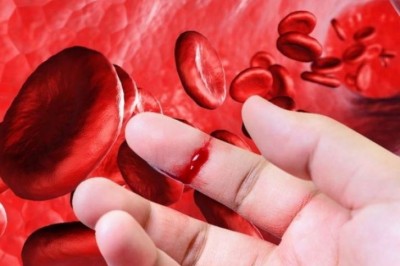 Hiểu về bệnh Hemophilia để tránh mang thêm những nỗi đau