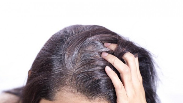 Chữa bệnh tóc bạc sớm tại nhà từ thảo dược rẻ tiền dễ mua ngoài chợ