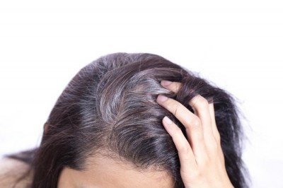 Chữa bệnh tóc bạc sớm tại nhà từ thảo dược rẻ tiền dễ mua ngoài chợ