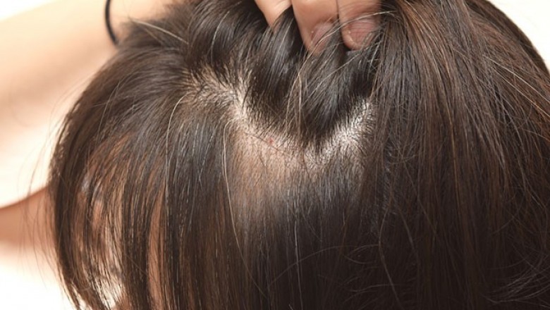 Những thực phẩm ngăn tóc bạc sớm và gãy rụng