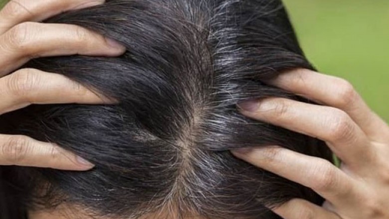 Bài thuốc đông y chữa tóc bạc sớm