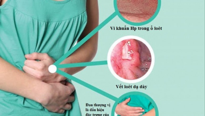 Bệnh viêm dạ dày tá tràng là gì? Nguyên nhân, triệu chứng và cách chữa bệnh viêm dạ dày tá tràng