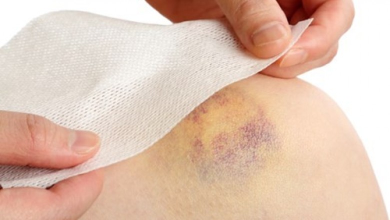 12 dấu hiệu thầm lặng của bệnh ung thư bạch cầu