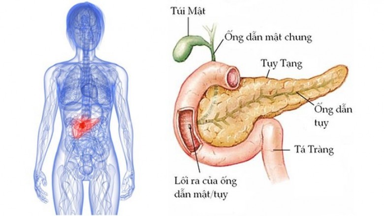Ung thư tuyến tụy, ung thư tụy