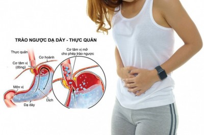 Bị bệnh trào ngược dạ dày nên ăn gì để bệnh nhanh thuyên giảm?