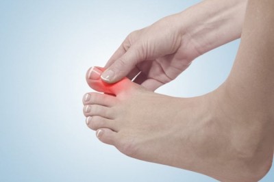 Chế độ ăn cho người bệnh gút, người mắc bệnh gút ăn gì tốt?