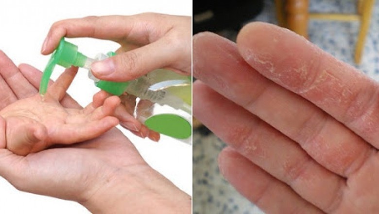 Hà Nội thu hồi 48 phiếu tiếp nhận công bố nước rửa tay khô