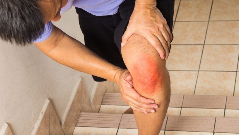 7 loại thực phẩm làm đau khớp nghiêm trọng hơn
