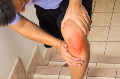 7 loại thực phẩm làm đau khớp nghiêm trọng hơn