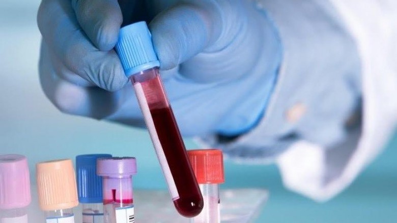 Nghiên cứu mới: Người có nhóm máu A dễ mắc Covid-19