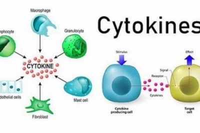 Hội chứng giải phóng Cytokine ở bệnh nhân Covid-19