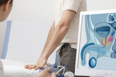 Những điều cần biết về ung thư tuyến tiền liệt