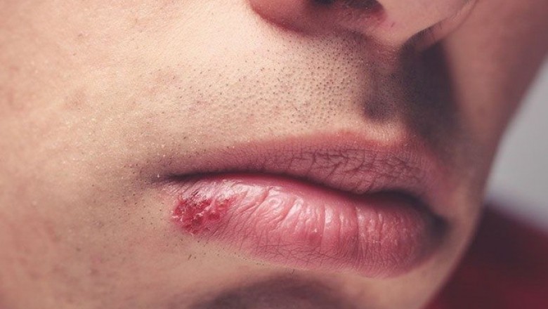 Bệnh thường gặp: Nhìn dấu hiệu trên mặt cảnh báo sức khỏe cần đi khám bác sĩ ngay