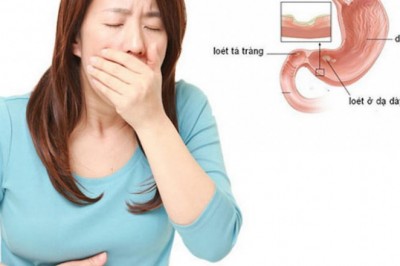 Vì sao thường đau dạ dày về đêm và sáng sớm?