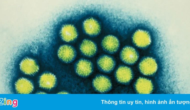 Hàng loạt ca nghi viêm gan bí ẩn được phát hiện ở Đông Nam Á