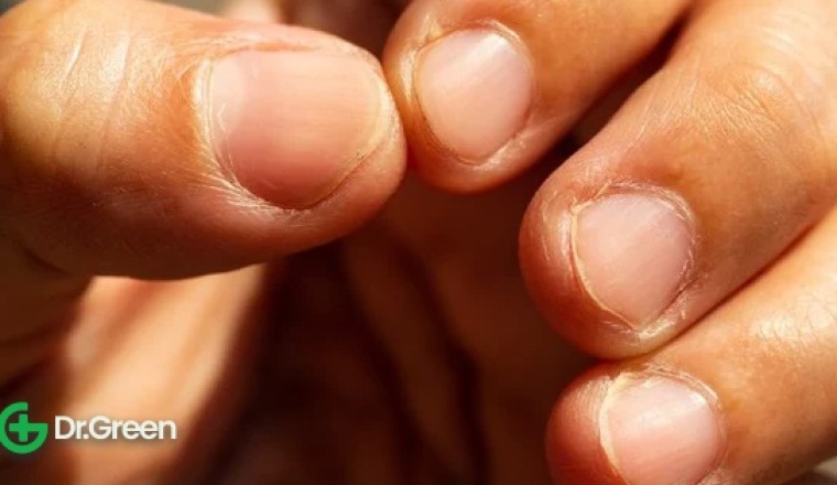 Nhận biết nhiều bệnh nguy hiểm về tim, gan, thận và kể cả ung thư đều có các dấu hiệu ở móng tay.