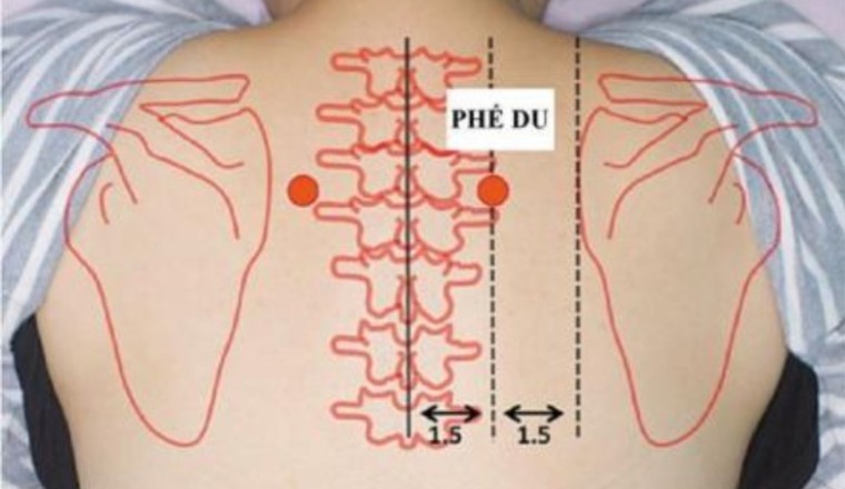 Người mắc bệnh viêm họng mạn tính có thể dùng sáu huyệt vị này để hỗ trợ phòng và trị viêm họng mạn tính