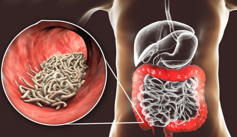 12 bài thuốc đông y, bài thuốc nam điều trị kiết lỵ cho trẻ em