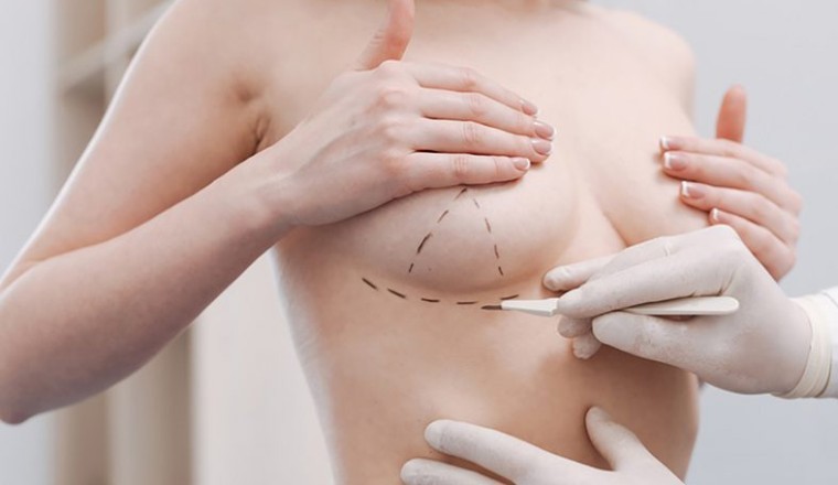 Túi độn ngực có thể gây ung thư