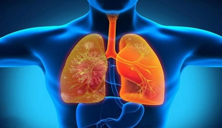 7 cây thuốc vị thuốc và món ăn hỗ trợ người bệnh phổi mạn tính lúc giao mùa