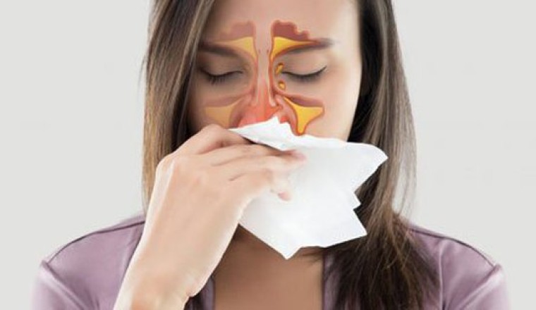 Chữa ngạt mũi, sổ mũi, cảm mạo, nhức đầu bằng cách day bấm ba huyệt này