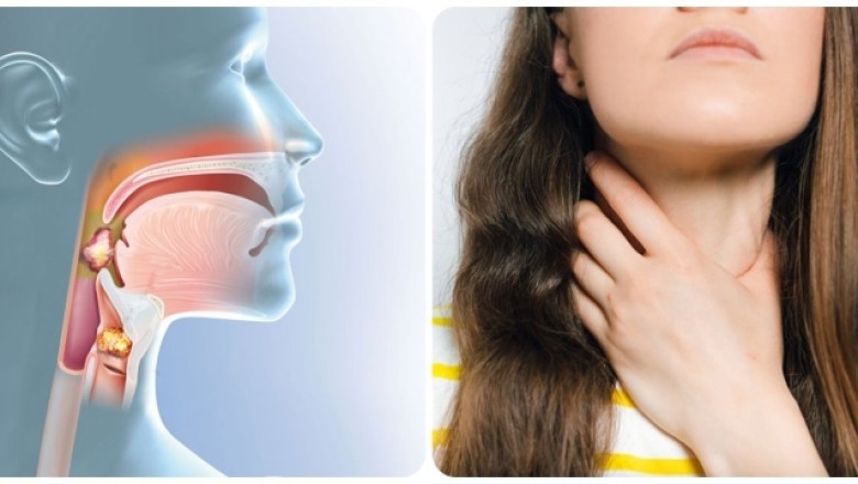 Đọc ngay để biết Dấu hiệu ung thư vòm họng giai đoạn đầu