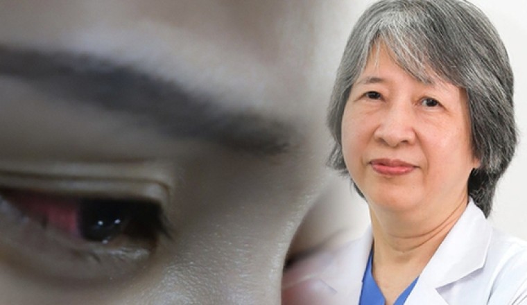 Đau mắt đỏ 2023: Bác sĩ chuyên khoa chia sẻ lý do bệnh đau mắt đỏ phức tạp hơn mọi năm và lưu ý quan trọng khi điều trị bệnh